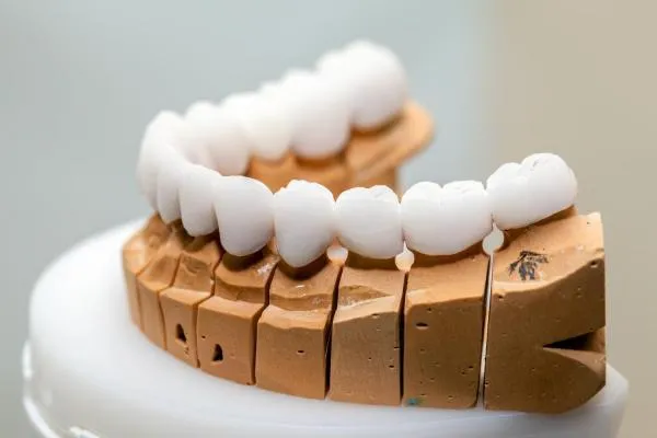 Zirconium Crowns illustration 1